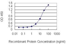 Anti-MYH3 Mouse Monoclonal Antibody [clone: 3H3]