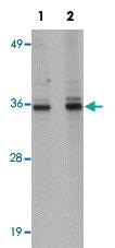 Anti-RSRC1 Rabbit Polyclonal Antibody