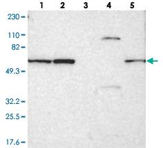 Anti-SMARCD1 Rabbit Polyclonal Antibody