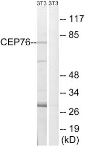 Western blot analysis of lysates from NIH/3T3 cells using Anti-CEP76 Antibody. The right hand lane represents a negative control, where the Antibody is blocked by the immunising peptide