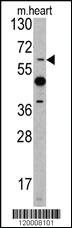 Anti-ETV4 Rabbit Polyclonal Antibody