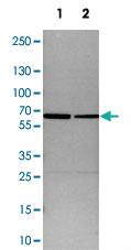 Anti-SMARCD1 Rabbit Polyclonal Antibody