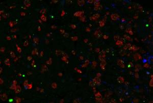 This antibody stained human brain stroke (including control cortex and stroke core areas) tissue. The primary antibody was incubated at 2.5 mg/ml overnight at 4?C. This was followed by a fluorophore conjugated secondary antibody. Optimal concentrations and conditions may vary.