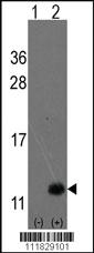 Anti-RB1CC1 Rabbit Polyclonal Antibody