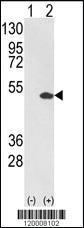 Anti-ETV4 Rabbit Polyclonal Antibody