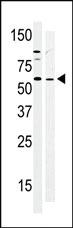 Anti-BRK (PTK6) Rabbit Polyclonal Antibody