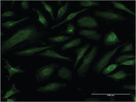 Anti-EIF1AY Mouse Monoclonal Antibody [clone: 2B8]