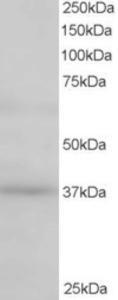 EB06118 staining (0.5µg/ml) of Human Kidney lysate (RIPA buffer, 35µg total protein per lane).  Primary incubated for 1 hour.  Detected by western blot using chemiluminescence.