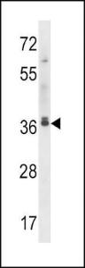 Anti-MAPRE2 Rabbit Polyclonal Antibody (HRP (Horseradish Peroxidase))