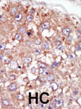 Anti-BRK (PTK6) Rabbit Polyclonal Antibody