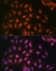 Immunofluorescence analysis of U-2 OS cells using Anti-DISC1 Antibody [ARC1089] (A307606) at a dilution of 1:100 (40x lens). DAPI was used to stain the cell nuclei (blue).