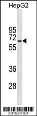 Anti-STK39 Mouse Monoclonal Antibody