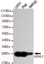 Anti-UCHL1 Mouse Monoclonal Antibody [clone: 13k137]