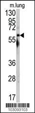 Anti-SRC Rabbit Polyclonal Antibody