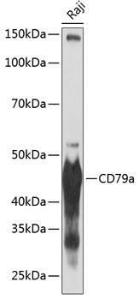 Western blot analysis of extracts of Raji cells, using Anti-CD79a Antibody [ARC0482] (A307607) at 1:1000 dilution