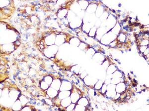 Anti-Clathrin Heavy Chain Rabbit Monoclonal Antibody [clone: ARC1228]