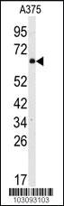 Anti-SRC Rabbit Polyclonal Antibody