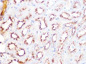 Anti-Clathrin Heavy Chain Rabbit Monoclonal Antibody [clone: ARC1228]