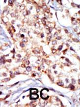 Anti-SRC Rabbit Polyclonal Antibody