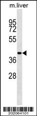 Anti-AHCY Mouse Monoclonal Antibody