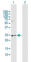 Anti-CSN1S1 Mouse Polyclonal Antibody