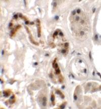 Anti-DBX1 Rabbit Polyclonal Antibody