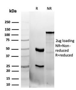 SDS-PAGE analysis of Anti-CD47 Antibody [CD47/6362R] under non-reduced and reduced conditions; showing intact IgG and intact heavy and light chains, respectively. SDS-PAGE analysis confirms the integrity and purity of the antibody