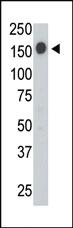 Anti-PTPRC Rabbit Polyclonal Antibody