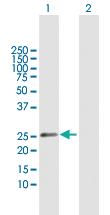 Anti-CSN1S1 Rabbit Polyclonal Antibody