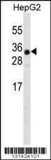 Anti-ANKRD46 Rabbit Polyclonal Antibody (FITC (Fluorescein Isothiocyanate))