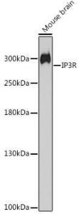 Western blot analysis of extracts of Mouse brain, using Anti-IP3 receptor Antibody (A308643) at 1:1,000 dilution The secondary antibody was Goat Anti-Rabbit IgG H&L Antibody (HRP) at 1:10,000 dilution Lysates/proteins were present at 25 µg per lane