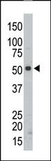 Anti-SRMS Rabbit Polyclonal Antibody