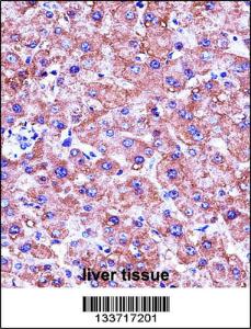 Anti-MBL2 Rabbit Polyclonal Antibody (FITC (Fluorescein Isothiocyanate))