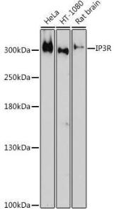 Western blot analysis of extracts of various cell lines, using Anti-IP3 receptor Antibody (A308643) at 1:1,000 dilution The secondary antibody was Goat Anti-Rabbit IgG H&L Antibody (HRP) at 1:10,000 dilution Lysates/proteins were present at 25 µg per lane