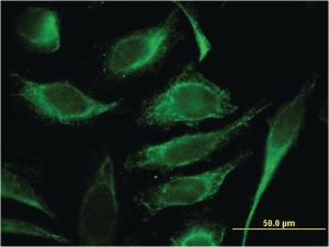 Anti-TMSB4Y Mouse Monoclonal Antibody [clone: 6G4]