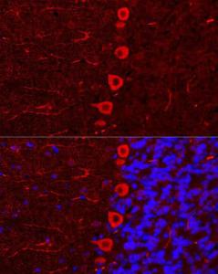 Immunofluorescence analysis of U-2 OS cells using Anti-IP3 receptor Antibody (A308643) at a dilution of 1:100 DAPI was used to stain the cell nuclei (blue) Perform microwave antigen retrieval with 10 mM citrate buffer pH 60 before commencing with IF staining protocol