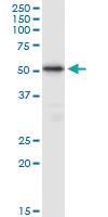 Anti-TUBB7P Mouse Polyclonal Antibody