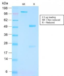 SDS-PAGE analysis of Anti-PSMA Antibody [FOLH1/3149R] under non-reduced and reduced conditions; showing intact IgG and intact heavy and light chains, respectively. SDS-PAGE analysis confirms the integrity and purity of the antibody