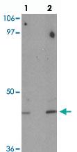 Anti-DBX1 Rabbit Polyclonal Antibody