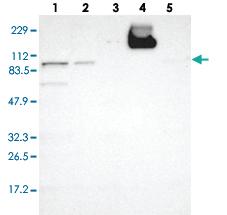 Anti-GIT1 Rabbit Polyclonal Antibody