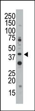 Anti-CD33 (SIGLEC3) Rabbit Polyclonal Antibody