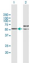 Anti-TUBB7P Mouse Polyclonal Antibody