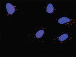 Anti-CASP3 + AKT3 Antibody Pair