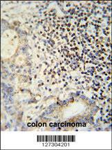 Anti-ESRP1 Rabbit Polyclonal Antibody (FITC (Fluorescein Isothiocyanate))