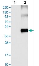 Anti-SLC16A7 Rabbit Polyclonal Antibody