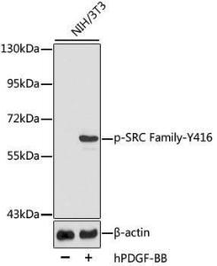 Western blot analysis of extracts of NIH3T3 cells, using Anti-SRC family (phospho Tyr416) Antibody (A10991)