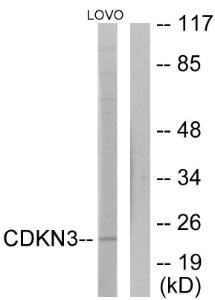 Anti-CDKN3 Rabbit Polyclonal Antibody