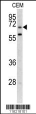 Anti-GARP Rabbit Polyclonal Antibody