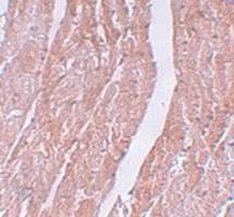 Anti-MINA Rabbit Polyclonal Antibody