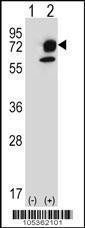 Anti-ITPKB Rabbit Polyclonal Antibody (PE (Phycoerythrin))